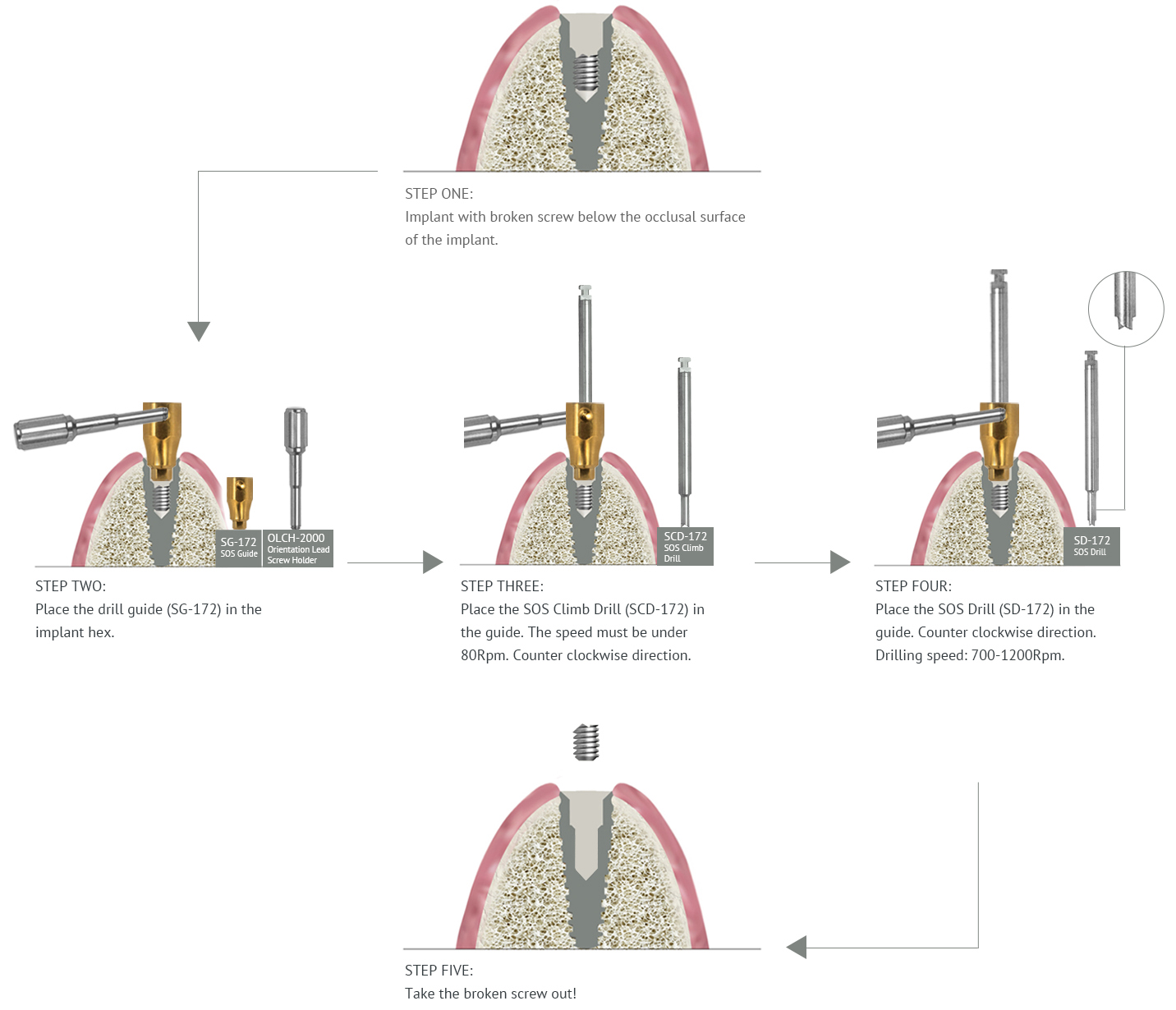 Screw Removal Kit | Dental Implants